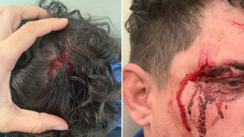 Rebelião e terror no CASE: servidor fica trancado no banheiro enquanto áudio denuncia videogames e 6 refeições para internos